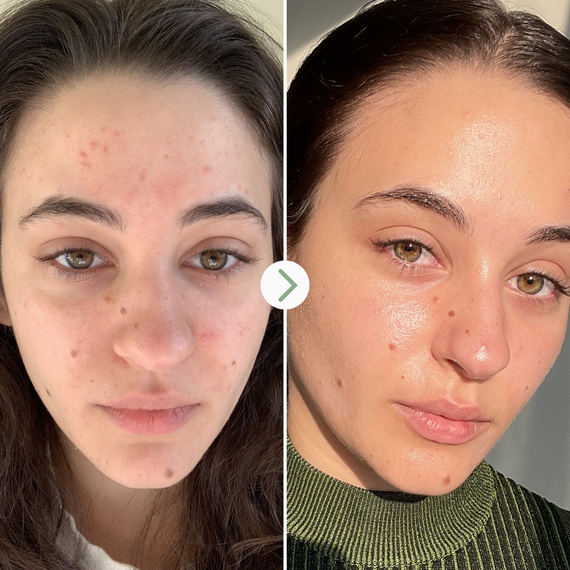 Pai Skincare - Carbon Star Detoxifying Overnight Face Oil - image 5 | Amazingy