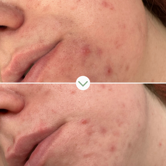 Pai Skincare - PHAZE | PHA Klärendes Reinigungsgel - image 5 | Amazingy