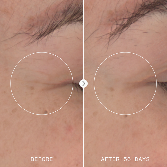 Pai Skincare - Age Confidence™ Renewal Serum - image 8 | Amazingy