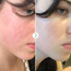Pai Skincare - The Light Fantastic™ Ceramide Face Oil - image 3 | Amazingy