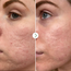 Pai Skincare - Acide Hyaluronique - Booster Hydratant - image 5