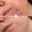 Pai Skincare - PHAZE | PHA Klärendes Reinigungsgel - image 5 | Amazingy